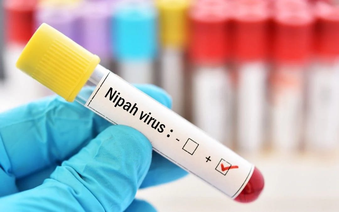 Nipah Virus