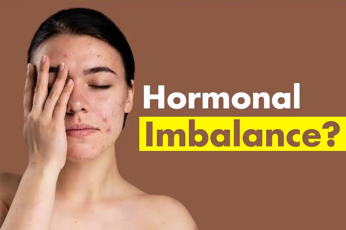 Hormonal imbalance