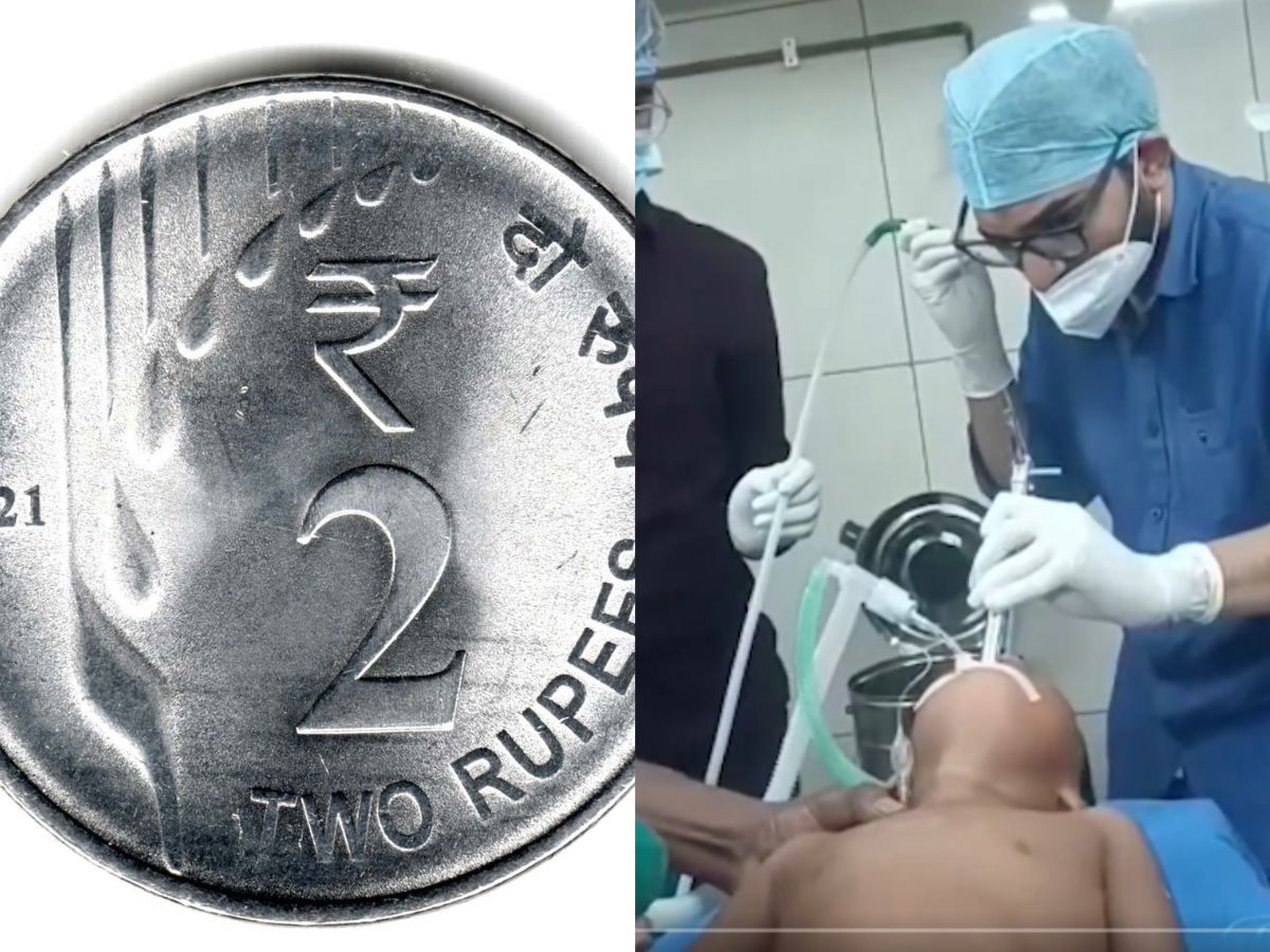 Atrocity in Kamareddy. A two-year-old boy swallowed a Rs.2 coin