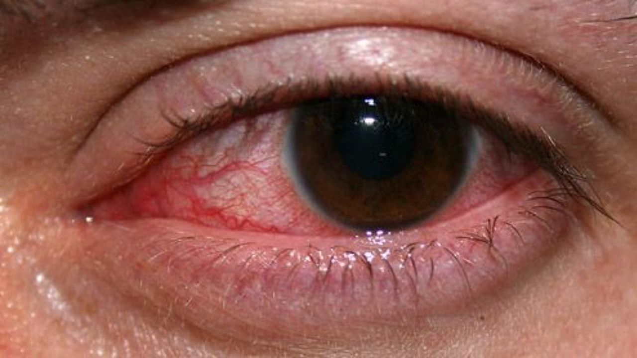 Eyes as Silent Indicators of Diabetes and Hypertension