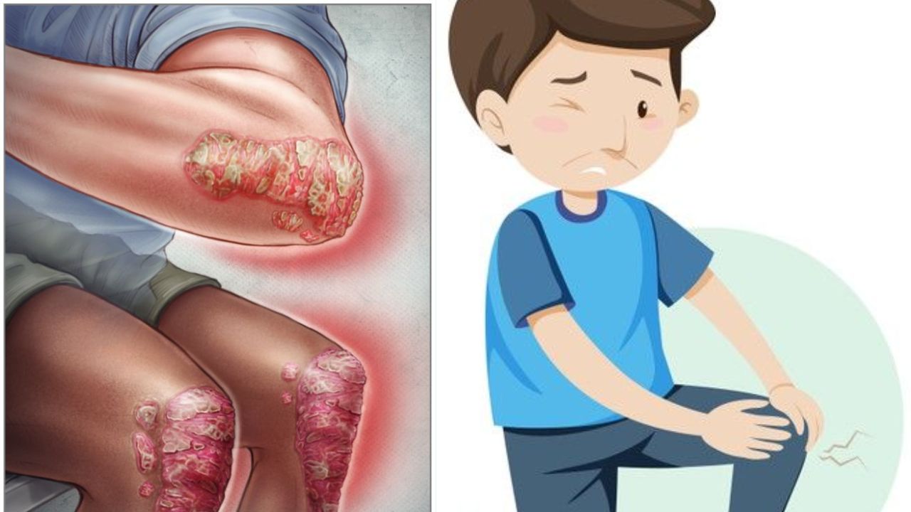 Do You Know the Warning Signs of Sarcoma in Children?