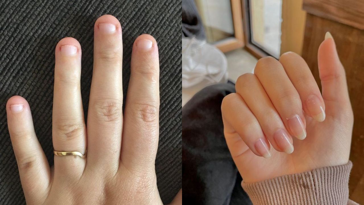 The Real Reason You Don’t Feel Pain While Cutting Nails!