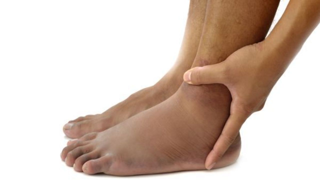 Leg Swelling Warning: Health Conditions Behind It