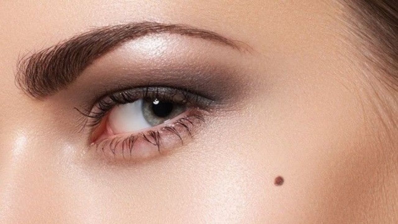 Palm Birthmarks – Do They Bring Wealth, Love, or Luck?