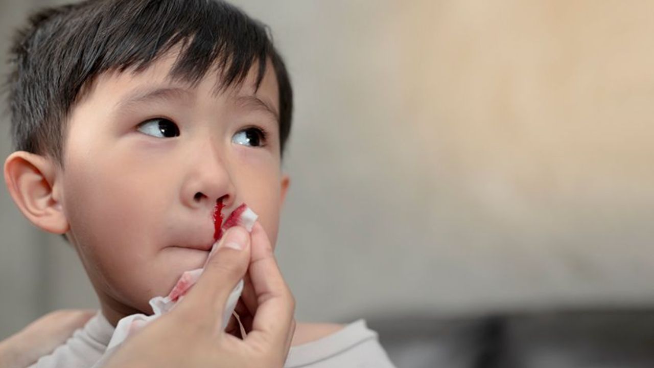 Causes Behind Nosebleeds in Children