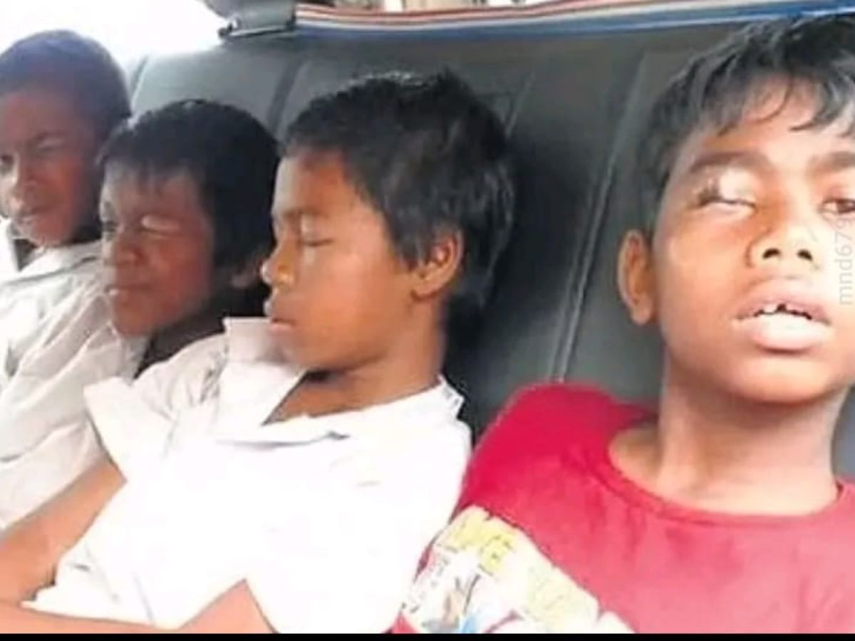 8 Odisha Students Hospitalised After Glue Applied To Eyes While Sleeping In School Hostel