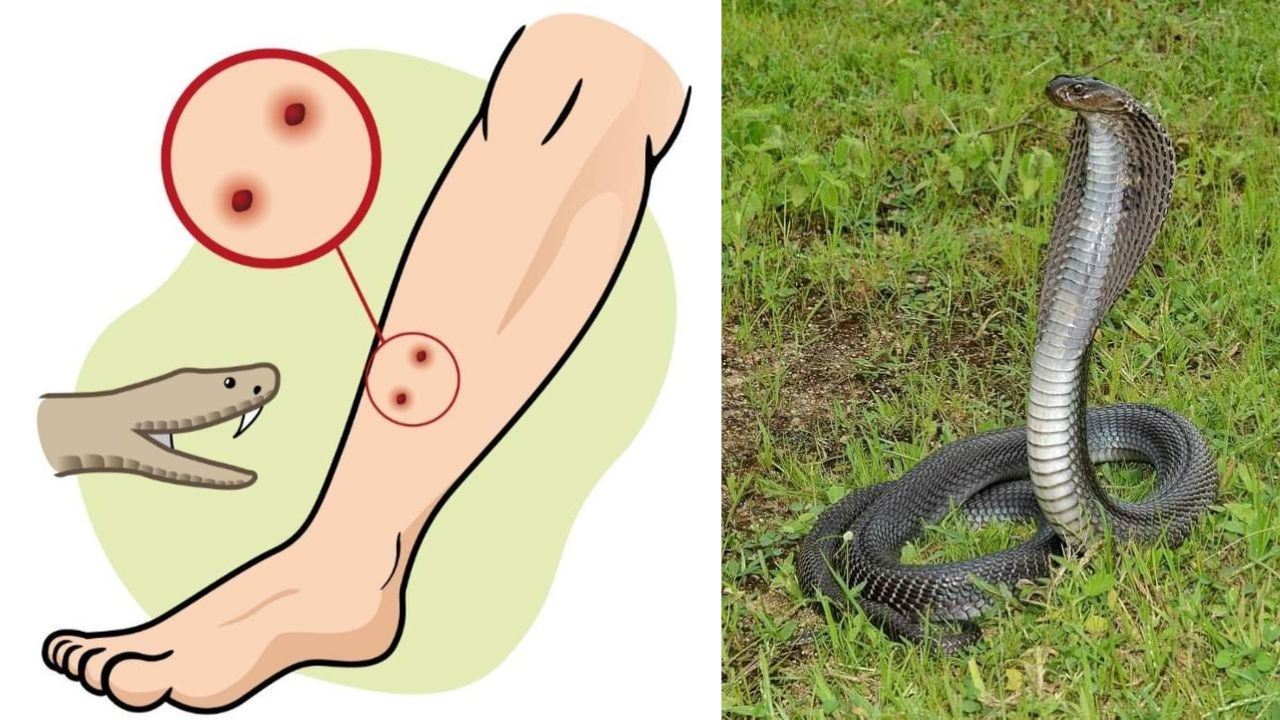 Expert-Approved Treatment for Rapid Snakebite Relief