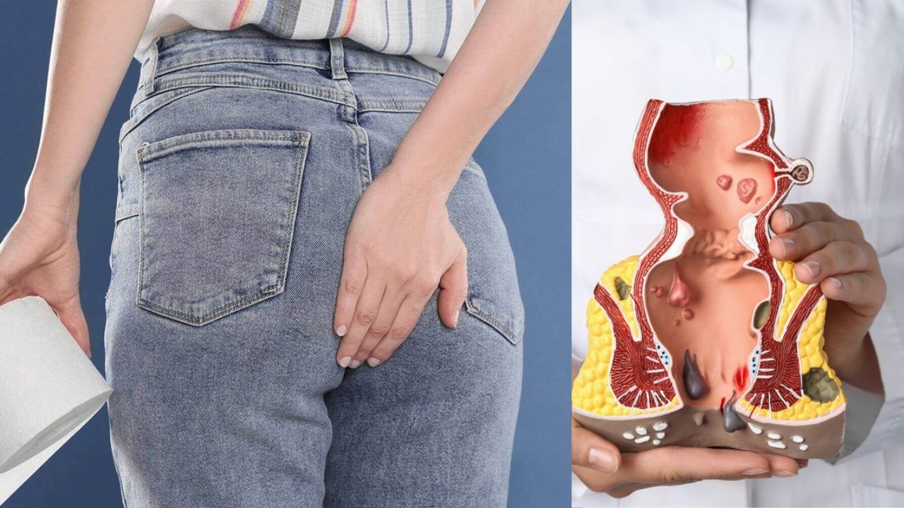 Fissure Awareness: Spotting the Problem Before It Worsens