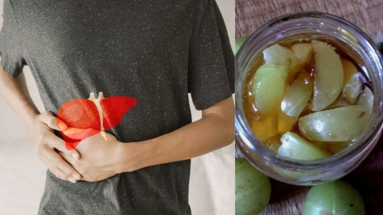 Natural Cure for Fatty Liver – Power of Amla and Honey!