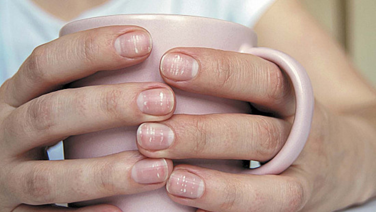 Are Nail White Spots a Warning Sign? The Actual Health Insight