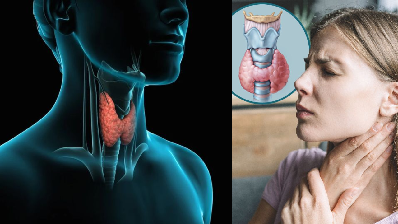 “Thyroid Alert: These 5 Foods Can Worsen Thyroid Problems in Women”