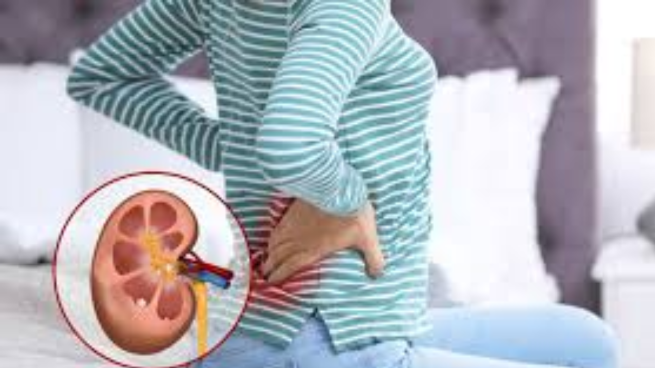 Warning Signs in Your Urine That May Indicate Kidney Stones