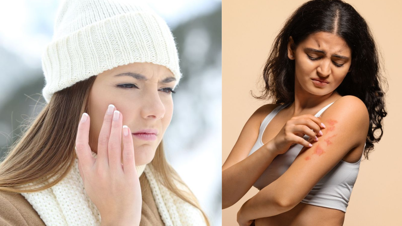 Seasonal Skin Problems? Easy Tips to Reduce Itchiness & Rashes
