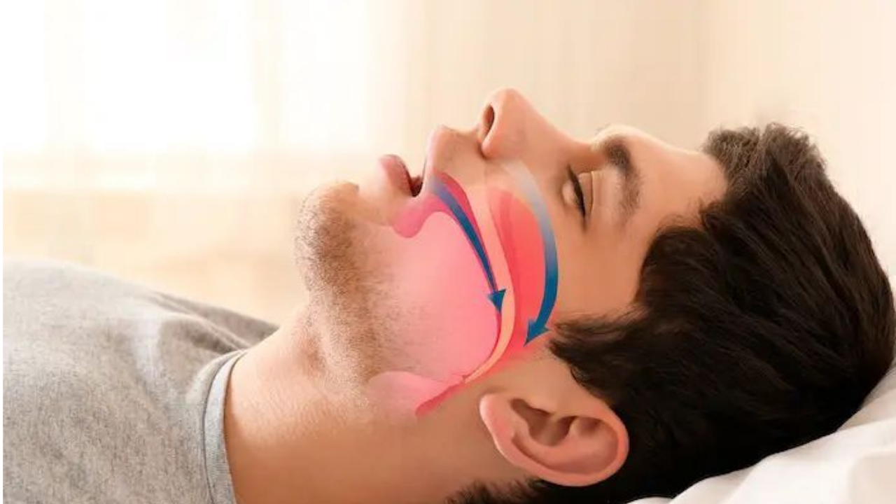 Sleep Apnea Explained: The Hidden Mental Health Risks You Shouldn’t Ignore