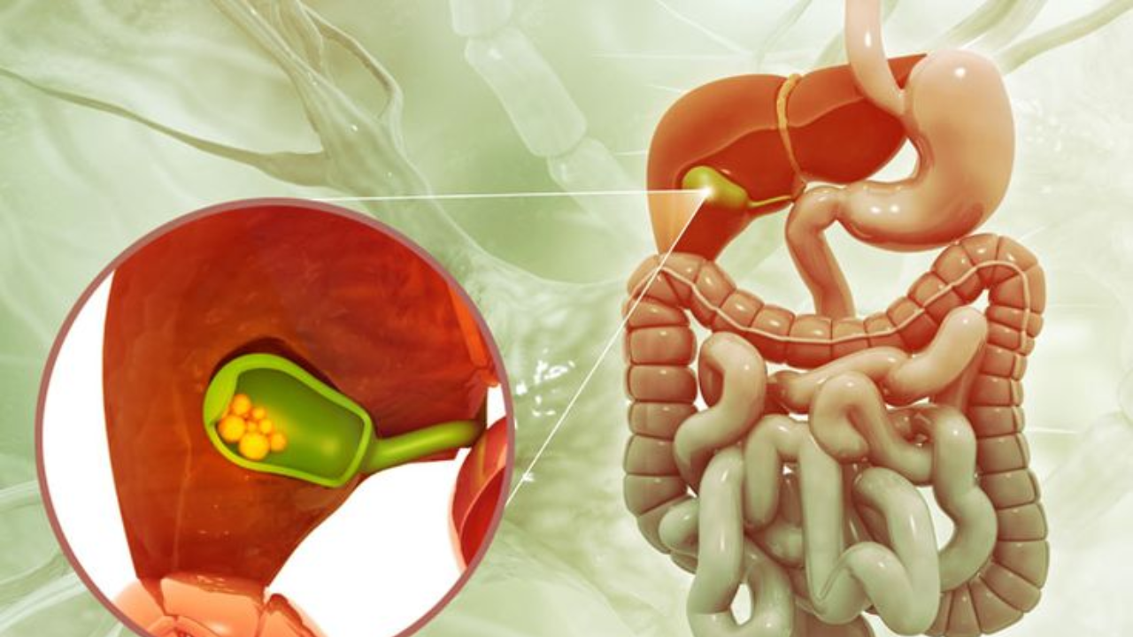 Think It’s Gas Pain? These Could Be Gallstones Symptoms