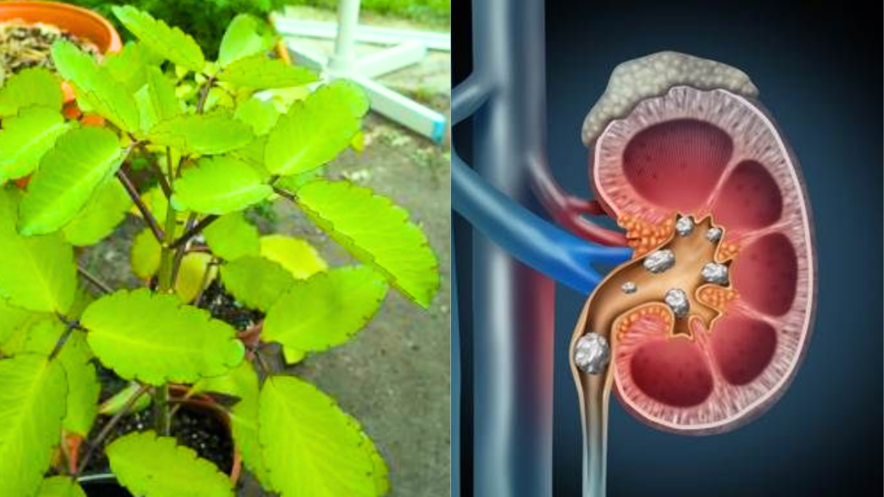 Ranapala Leaf and Kidney Stones: Benefits, Uses, and Facts