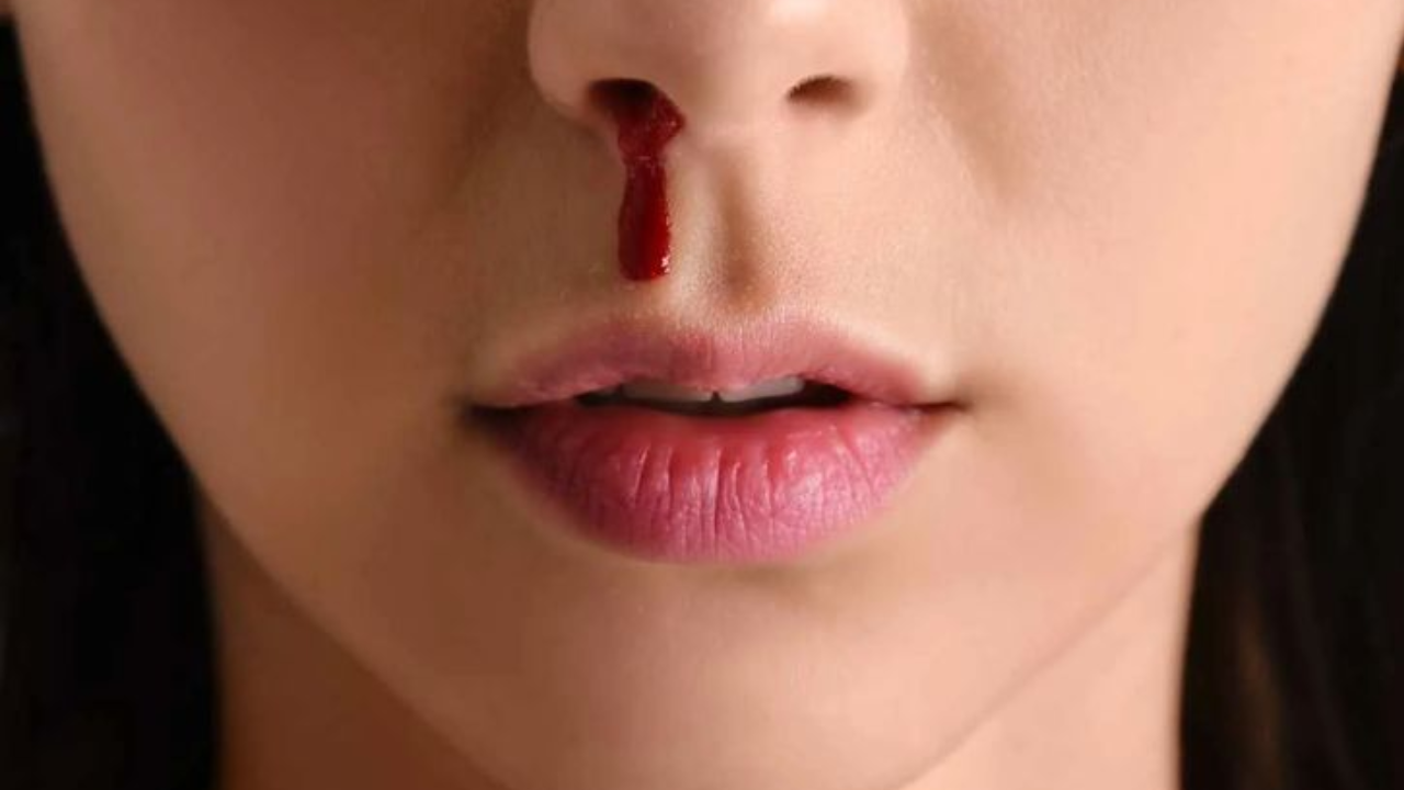 Why Does Nose Bleeding Happen? Common Reasons and Quick Safety Measures