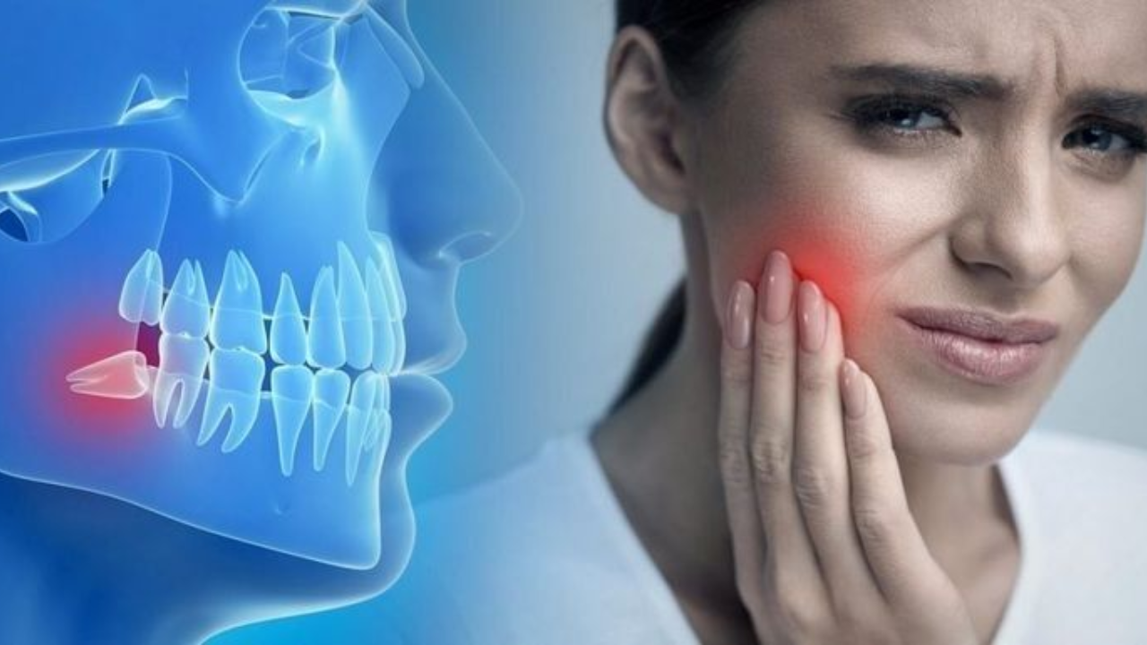 What Really Causes Wisdom Tooth Pain? Is Removal the Best Option?