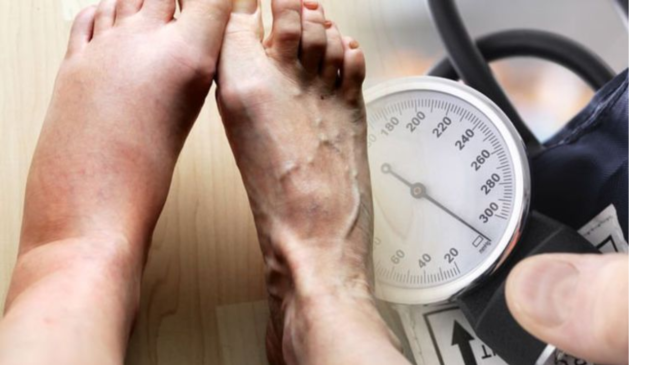Does High BP Cause Swelling? Here’s How the Body Responds