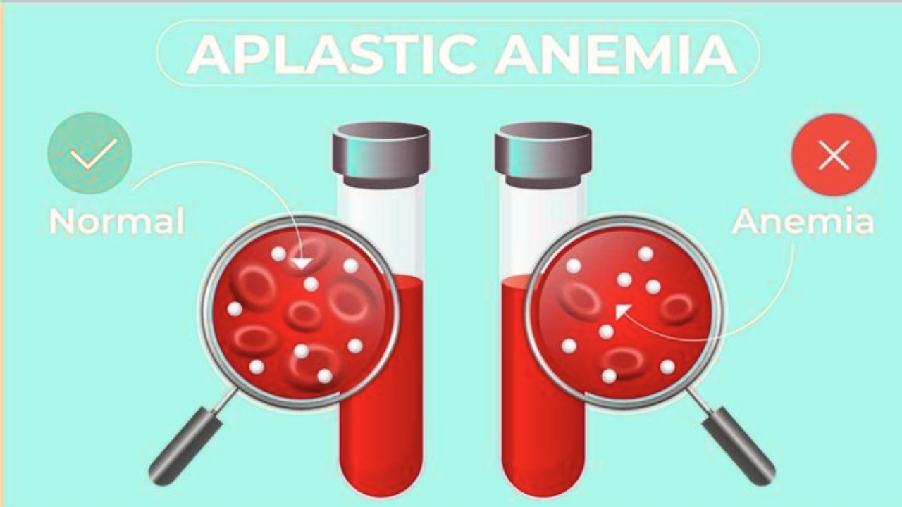 Why Is It Hard to Find a Stem Cell Match for Aplastic Anemia Patients?