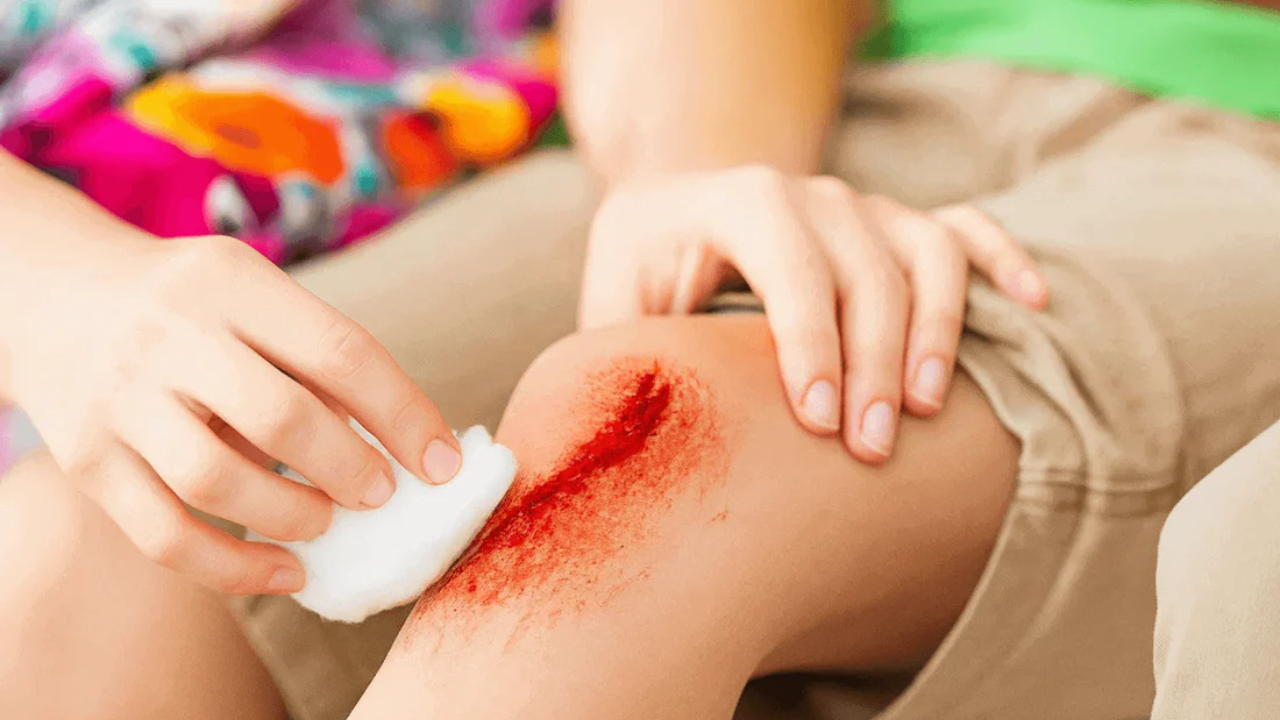 New Research Reveals Secret to Faster Wound Healing