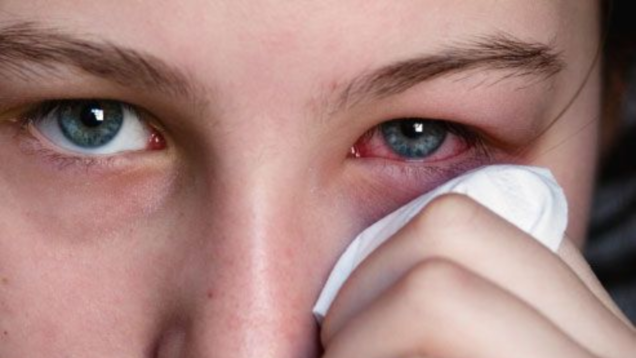 Shocking Report on Eye Infections: 45% Bacteria Found Drug-Resistant