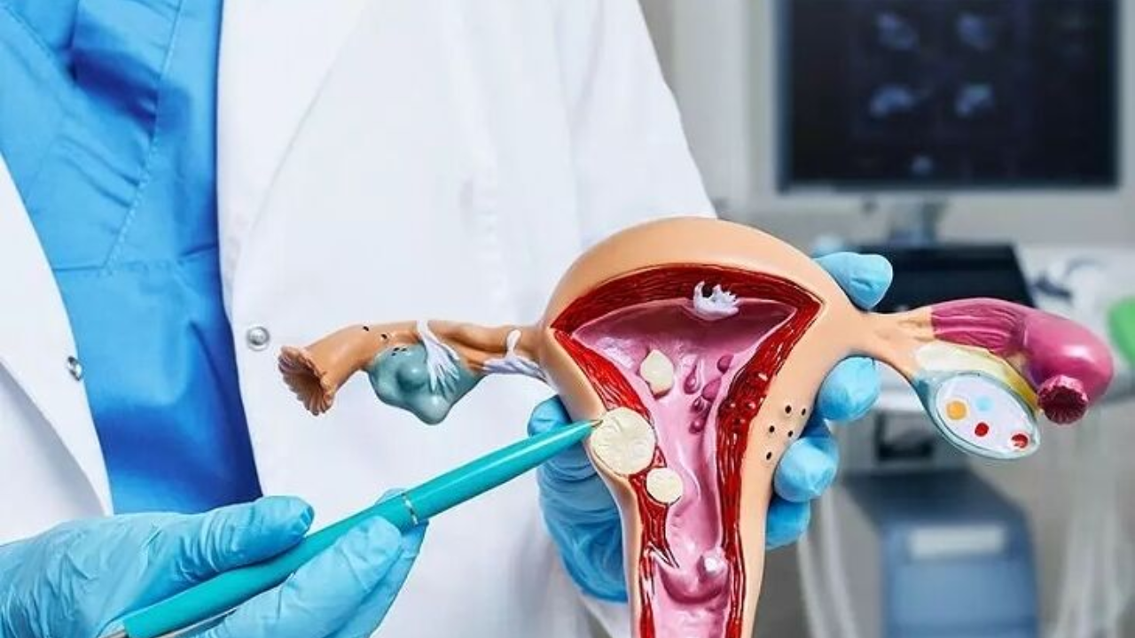 Do You Know the Problems Caused by Uterine Fibroids?