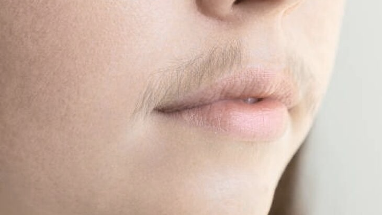 Female Facial Hair Explained: The Hormonal Causes Behind It
